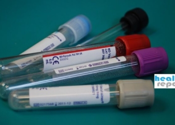 Διαγνωστικά Κέντρα: Ακυρώνεται η τριήμερη απεργία! Τι αποφάσισε ο κλάδος