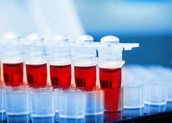 Μόλις 20 ευρώ καταβάλλουν οι Έλληνες για την πρόληψη έναντι 89 ευρώ που είναι ο μέσος όρος στην Ευρώπη