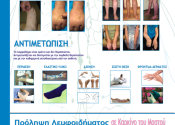 ΔΕΛΤΙΟ ΤΥΠΟΥ Ημέρα Ενημέρωσης για το Λεμφοίδημα: 06 Μαρτίου 2020